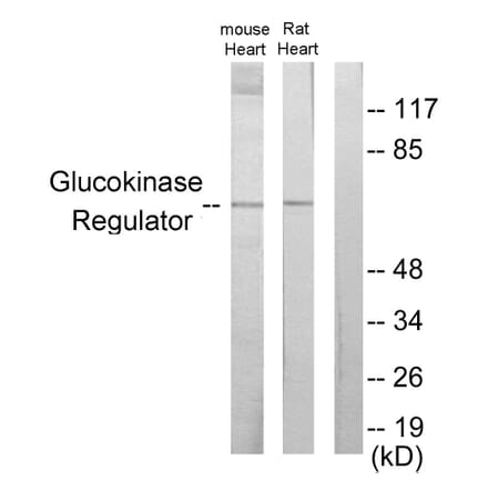 Western Blot - Anti-Glucokinase Regulator Antibody (C11030) - Antibodies.com