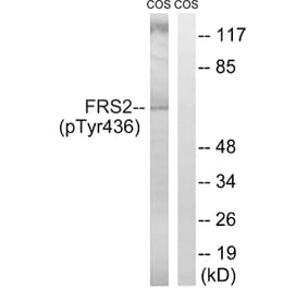 Western Blot - Anti-FRS2 (phospho Tyr436) Antibody (A8239) - Antibodies.com