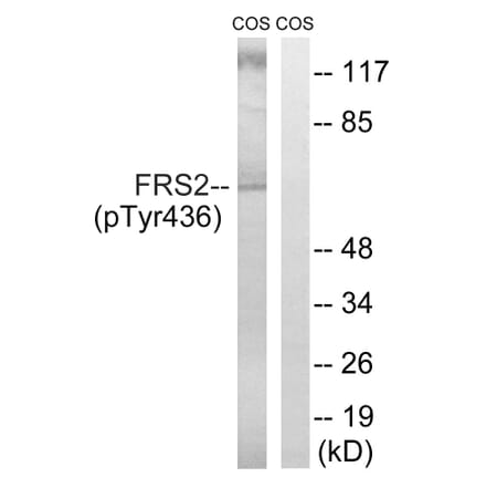 Western Blot - Anti-FRS2 (phospho Tyr436) Antibody (A8239) - Antibodies.com