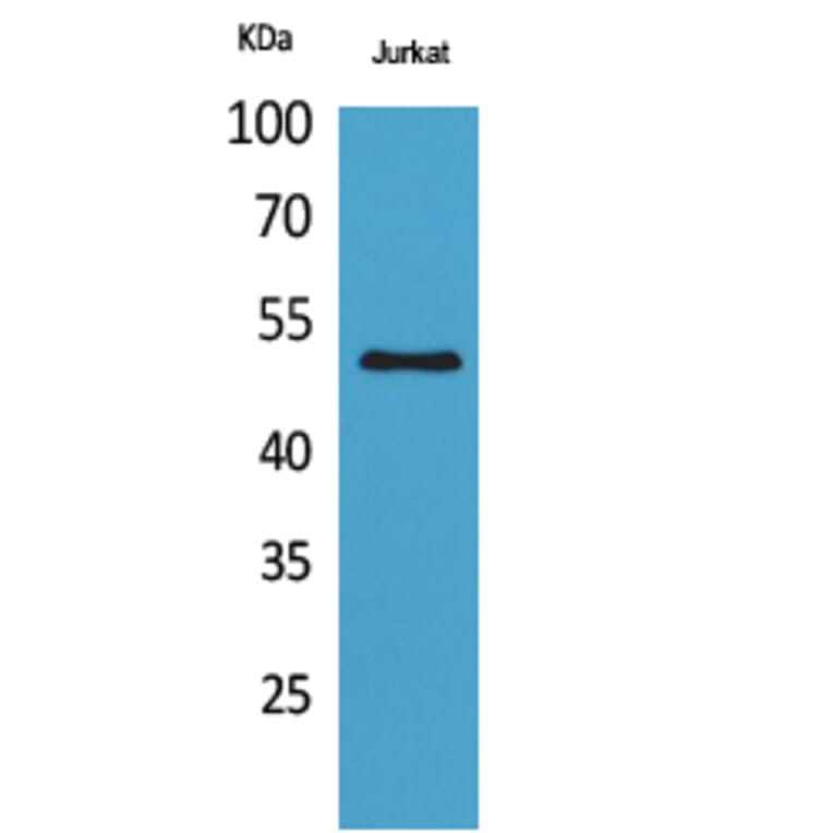 Western Blot - Anti-FOXA1 (acetyl Lys265) Antibody (D12070) - Antibodies.com