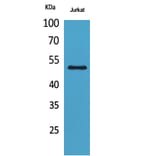 Western Blot - Anti-FOXA1 (acetyl Lys265) Antibody (D12070) - Antibodies.com