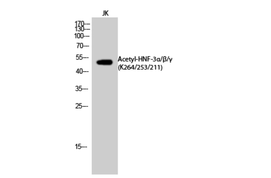 Western Blot - Anti-FOXA1 (acetyl Lys265) Antibody (D12070) - Antibodies.com