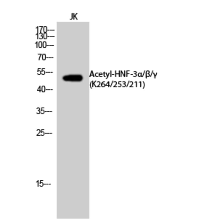 Western Blot - Anti-FOXA1 (acetyl Lys265) Antibody (D12070) - Antibodies.com