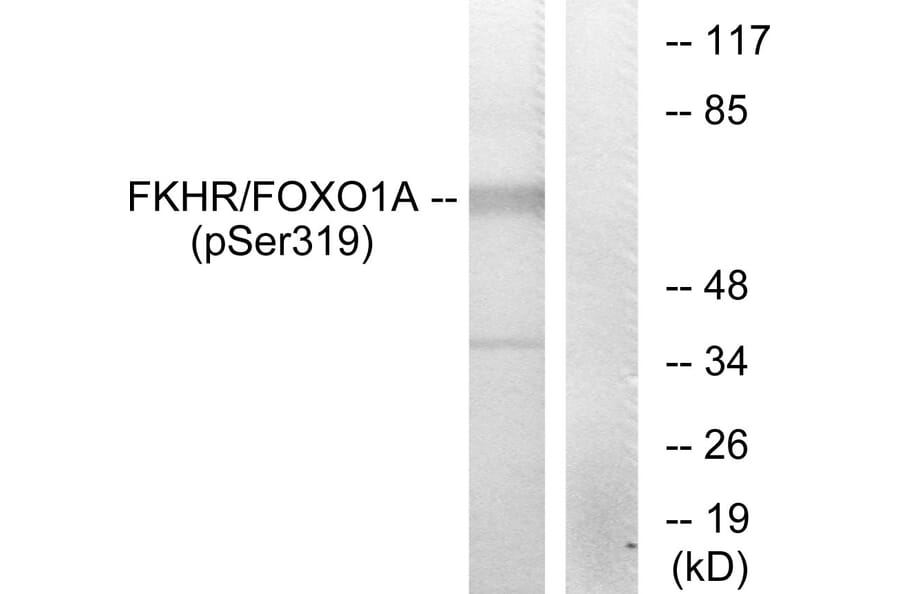 Western Blot - Anti-FKHR (phospho Ser319) Antibody (A7086) - Antibodies.com