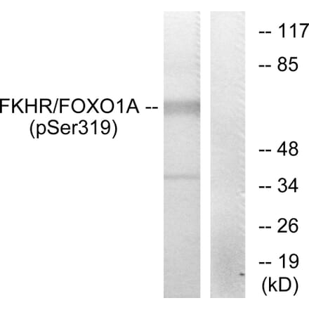 Western Blot - Anti-FKHR (phospho Ser319) Antibody (A7086) - Antibodies.com