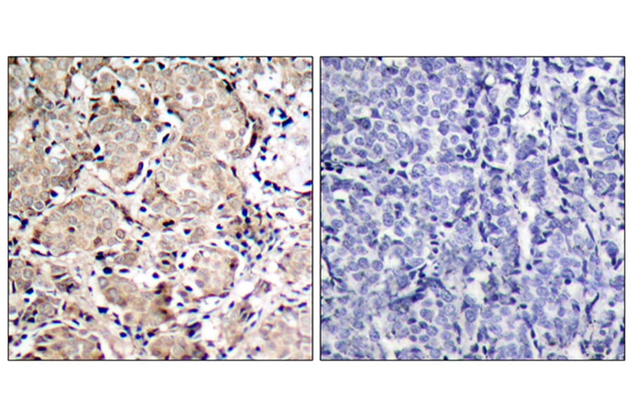 Immunohistochemistry - Anti-FKHR (phospho Ser319) Antibody (A7086) - Antibodies.com