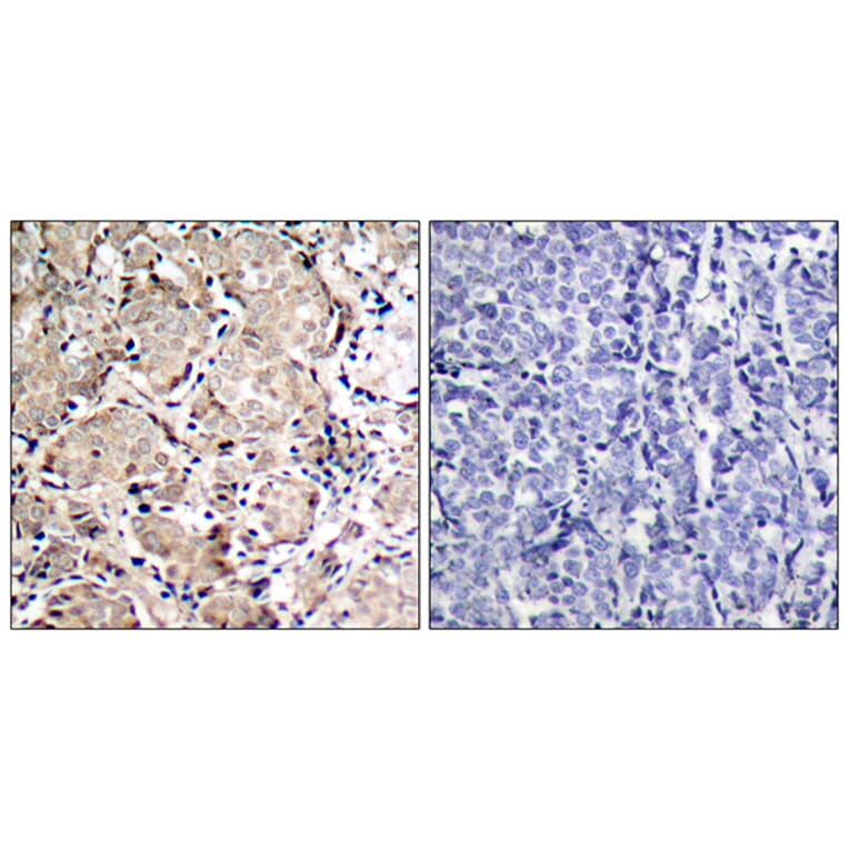 Immunohistochemistry - Anti-FKHR (phospho Ser319) Antibody (A7086) - Antibodies.com
