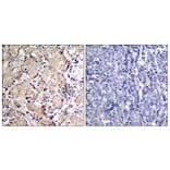 Immunohistochemistry - Anti-FKHR (phospho Ser319) Antibody (A7086) - Antibodies.com