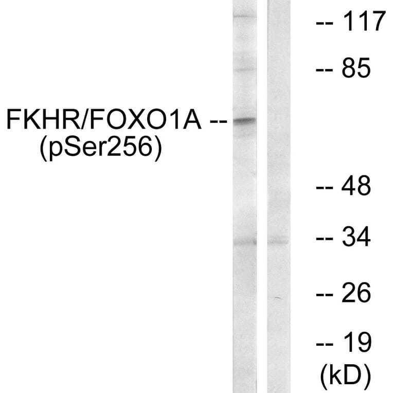 Western Blot - Anti-FKHR (phospho Ser256) Antibody (A7085) - Antibodies.com