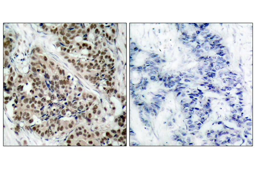 Immunohistochemistry - Anti-FKHR (phospho Ser256) Antibody (A7085) - Antibodies.com