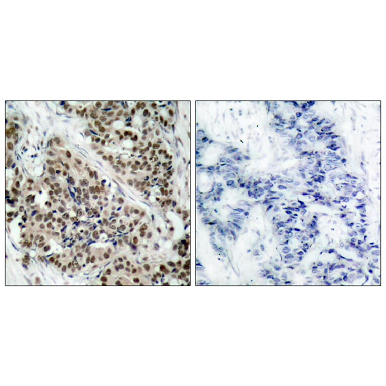 Immunohistochemistry - Anti-FKHR (phospho Ser256) Antibody (A7085) - Antibodies.com