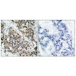 Immunohistochemistry - Anti-FKHR (phospho Ser256) Antibody (A7085) - Antibodies.com
