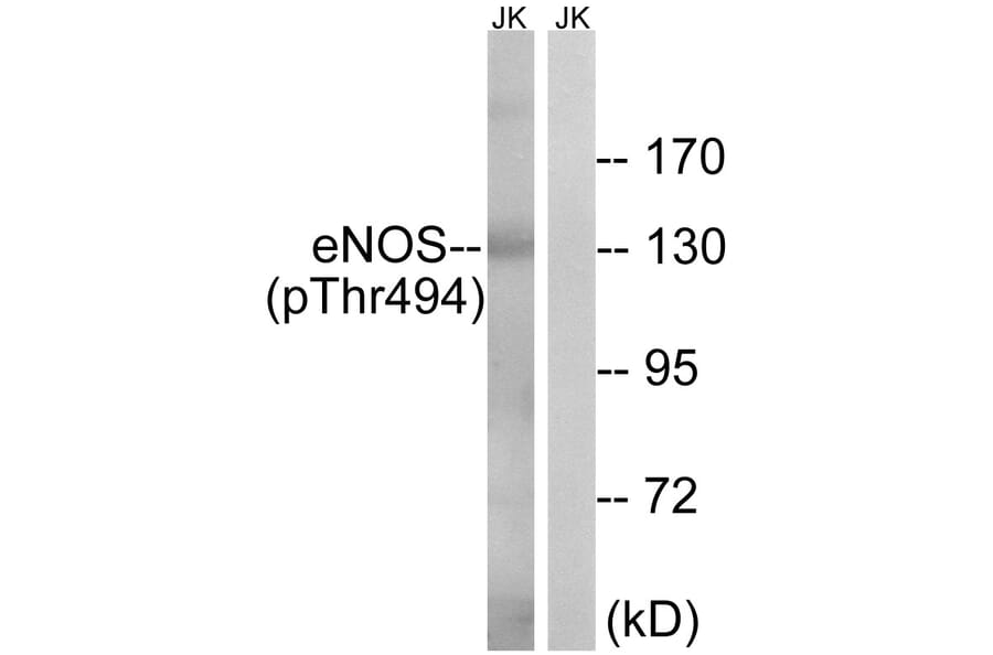 Western Blot - Anti-eNOS (phospho Thr494) Antibody (A7072) - Antibodies.com