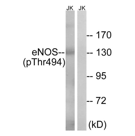Western Blot - Anti-eNOS (phospho Thr494) Antibody (A7072) - Antibodies.com