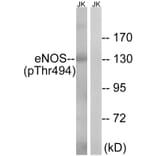 Western Blot - Anti-eNOS (phospho Thr494) Antibody (A7072) - Antibodies.com