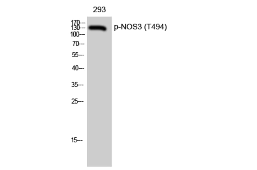 Western Blot - Anti-eNOS (phospho Thr494) Antibody (A7072) - Antibodies.com