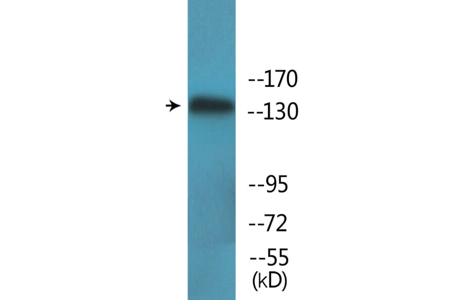 Western Blot - Anti-eNOS (phospho Thr494) Antibody (P12-1100) - Antibodies.com