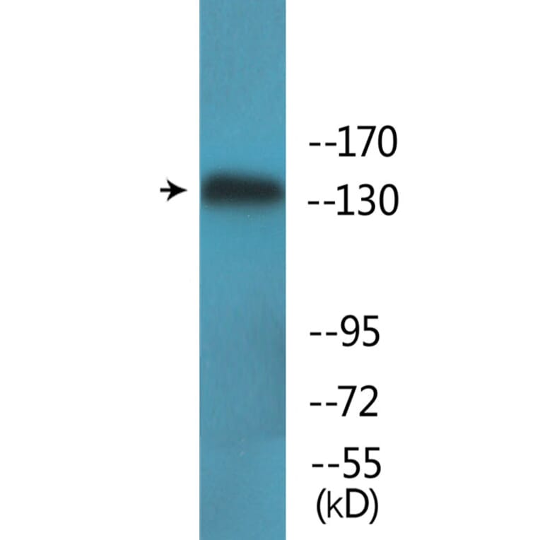 Western Blot - Anti-eNOS (phospho Thr494) Antibody (P12-1100) - Antibodies.com
