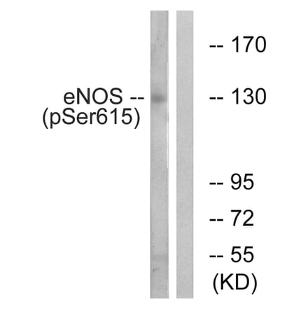 Western Blot - Anti-eNOS (phospho Ser615) Antibody (A1145) - Antibodies.com
