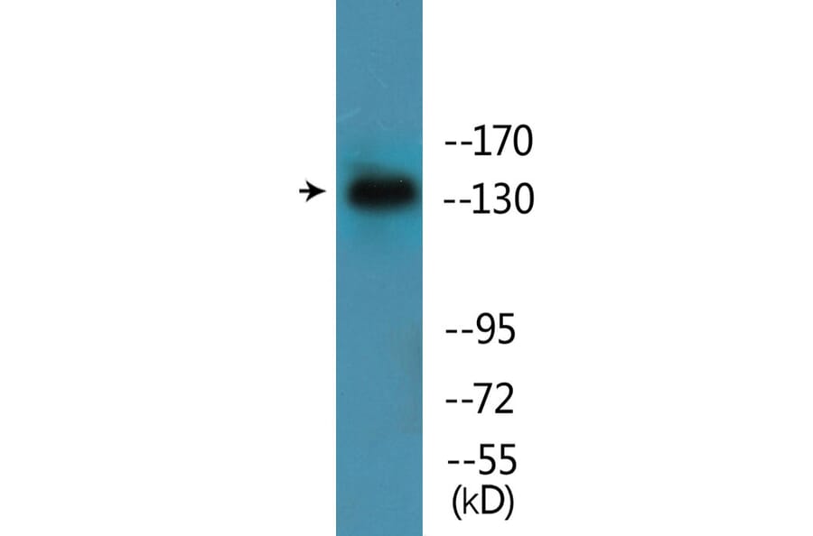 Western Blot - Anti-EGFR (phospho Ser695) Antibody (P12-1097) - Antibodies.com