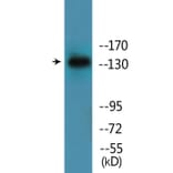 Western Blot - Anti-EGFR (phospho Ser695) Antibody (P12-1097) - Antibodies.com