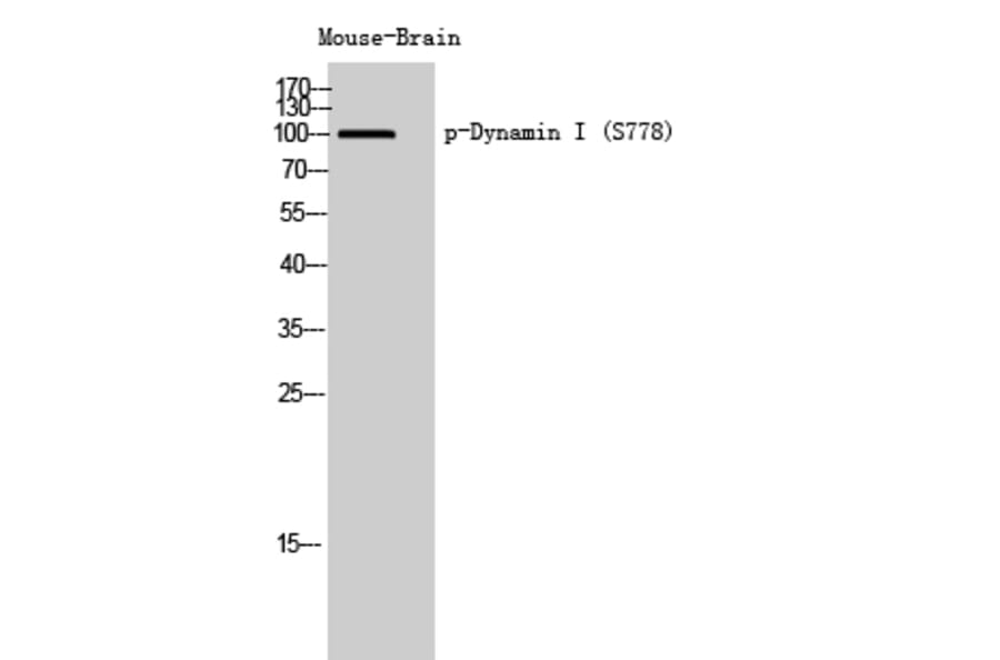 Western Blot - Anti-DYN1 (phospho Ser778) Antibody (A8227) - Antibodies.com