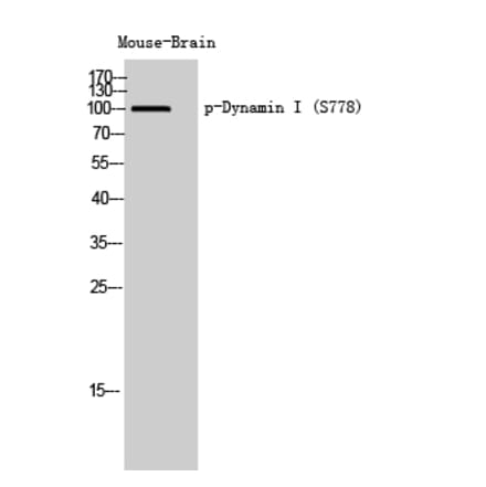 Western Blot - Anti-DYN1 (phospho Ser778) Antibody (A8227) - Antibodies.com