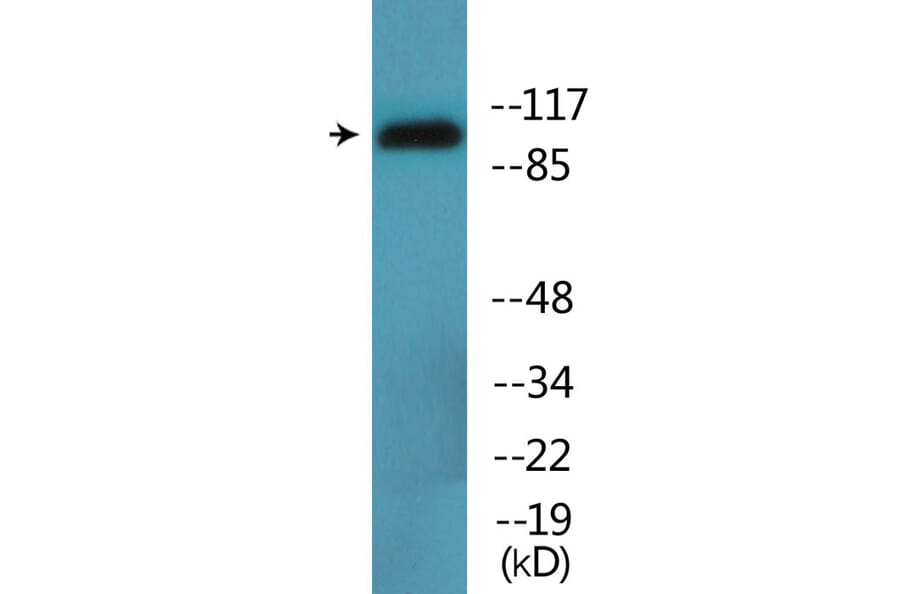 Western Blot - Anti-DYN1 (phospho Ser778) Antibody (P12-1095) - Antibodies.com