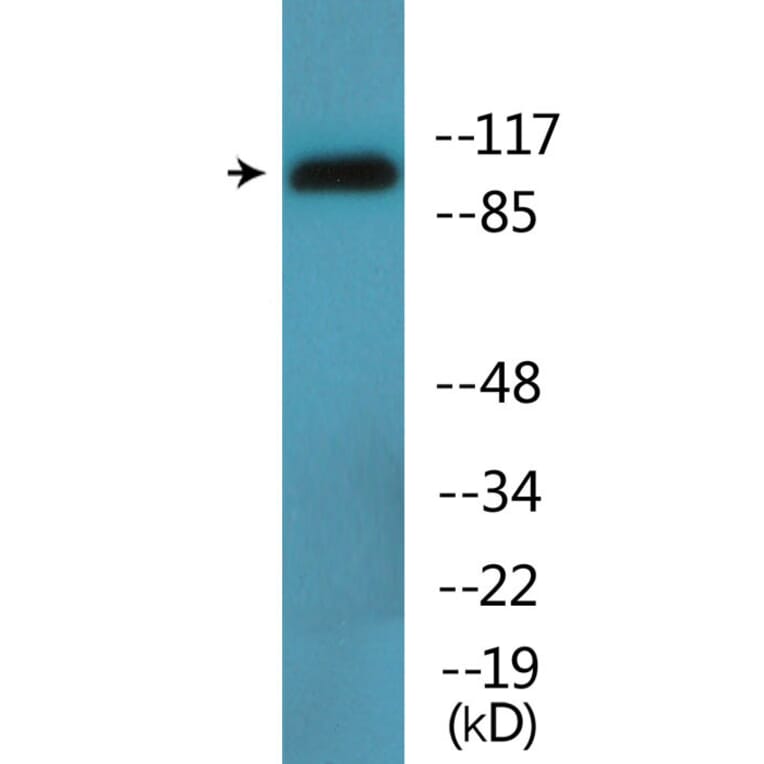 Western Blot - Anti-DYN1 (phospho Ser778) Antibody (P12-1095) - Antibodies.com