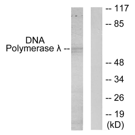 Western Blot - Anti-DNA Polymerase lambda Antibody (C11836) - Antibodies.com