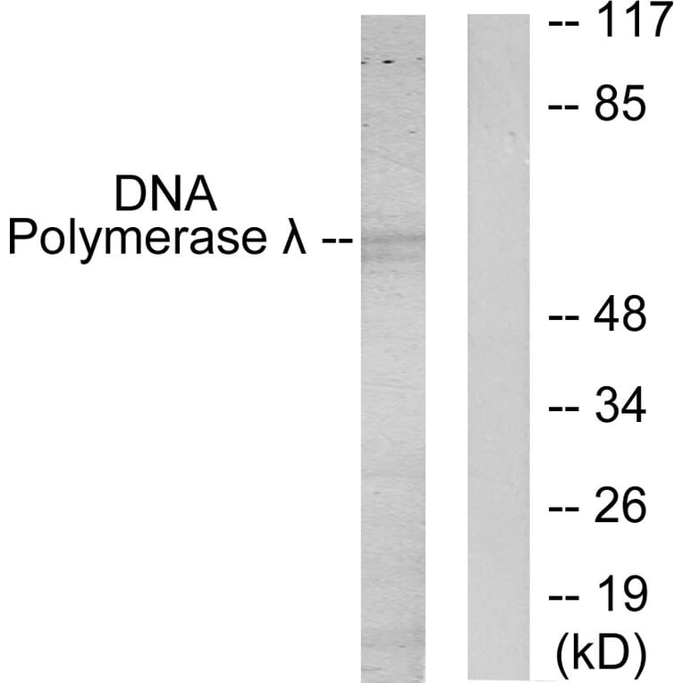 Western Blot - Anti-DNA Polymerase lambda Antibody (C11836) - Antibodies.com