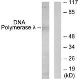 Western Blot - Anti-DNA Polymerase lambda Antibody (C11836) - Antibodies.com