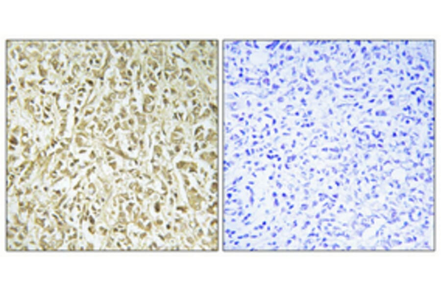 Immunohistochemistry - Anti-DNA Polymerase lambda Antibody (C11836) - Antibodies.com