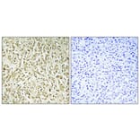 Immunohistochemistry - Anti-DNA Polymerase lambda Antibody (C11836) - Antibodies.com
