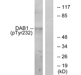 Western Blot - Anti-Dab1 (phospho Tyr232) Antibody (A7055) - Antibodies.com