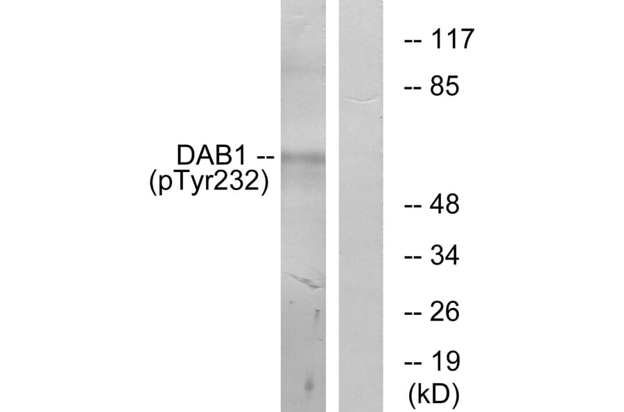 Western Blot - Anti-Dab1 (phospho Tyr232) Antibody (A7055) - Antibodies.com