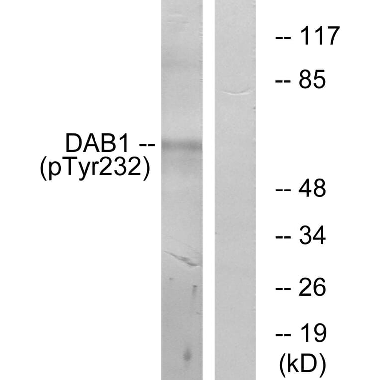 Western Blot - Anti-Dab1 (phospho Tyr232) Antibody (A7055) - Antibodies.com