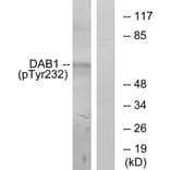 Western Blot - Anti-Dab1 (phospho Tyr232) Antibody (A7055) - Antibodies.com