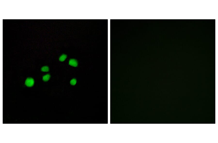 Immunofluorescence - Anti-Collagen XXIII alpha1 Antibody (C12226) - Antibodies.com