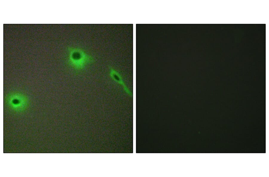 Immunofluorescence - Anti-Collagen XVIII alpha1 Antibody (C12223) - Antibodies.com