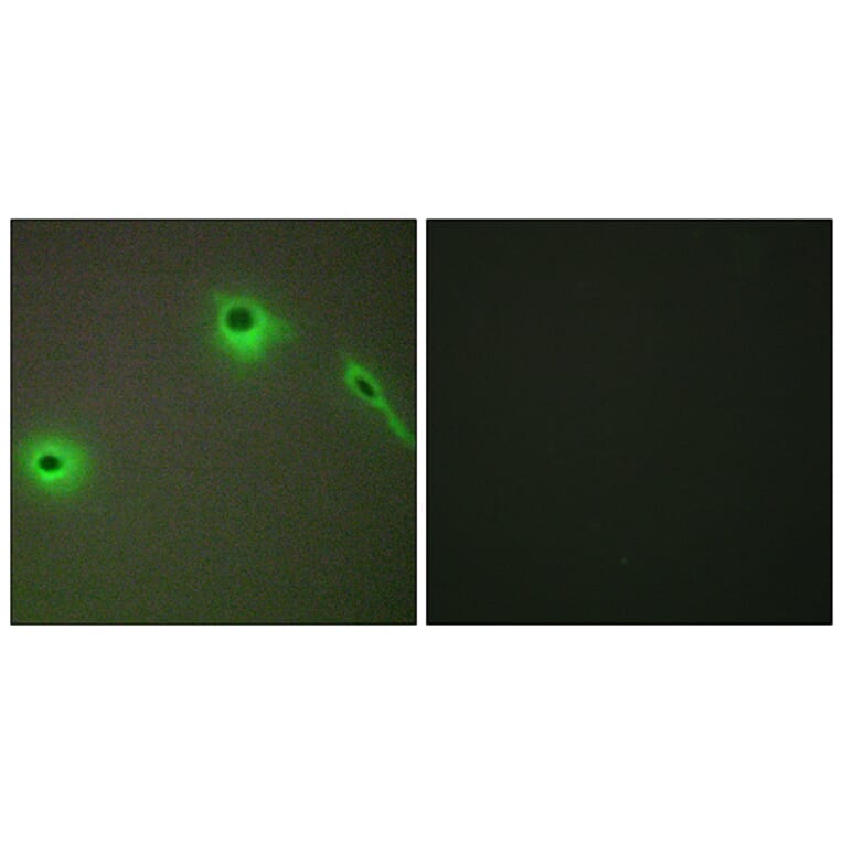 Immunofluorescence - Anti-Collagen XVIII alpha1 Antibody (C12223) - Antibodies.com