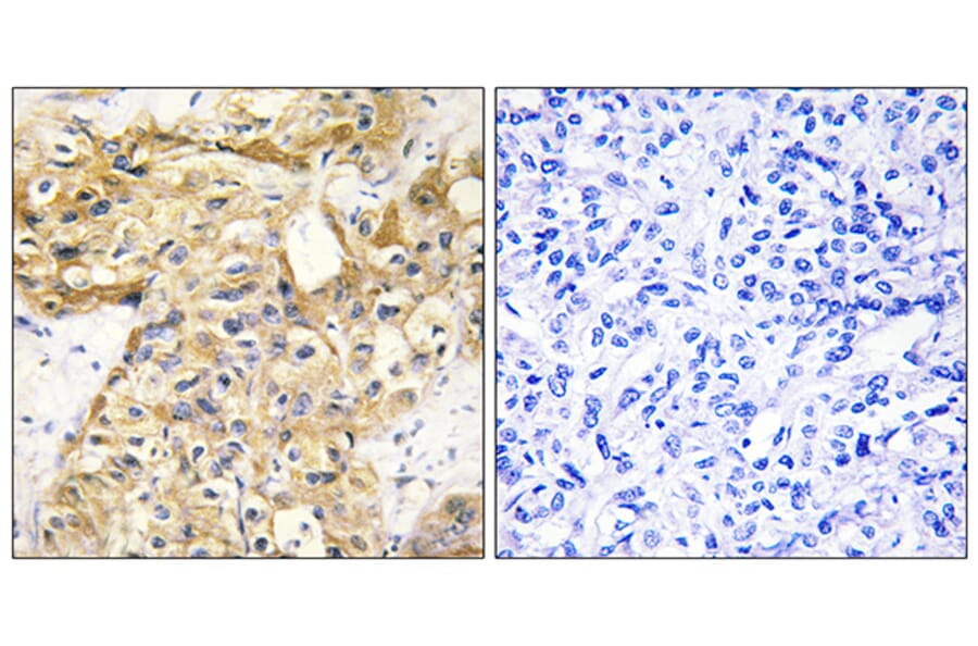 Immunohistochemistry - Anti-Collagen XVIII alpha1 Antibody (C12223) - Antibodies.com