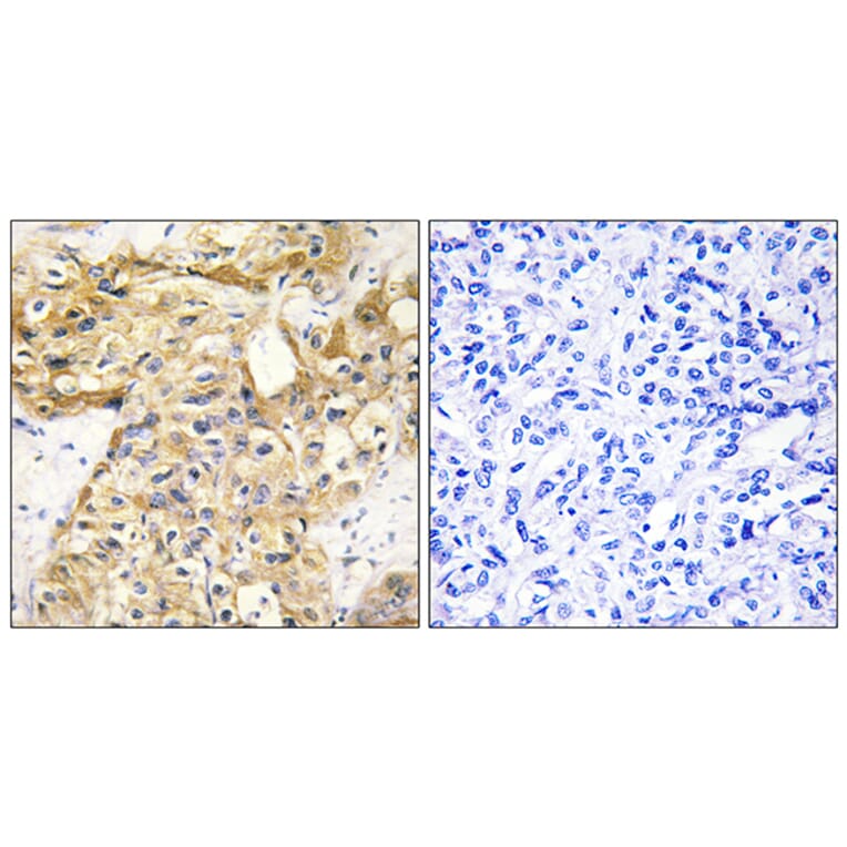 Immunohistochemistry - Anti-Collagen XVIII alpha1 Antibody (C12223) - Antibodies.com