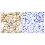 Immunohistochemistry - Anti-Collagen XVIII alpha1 Antibody (C12223) - Antibodies.com