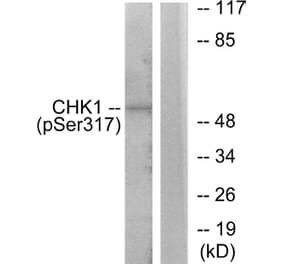 Western Blot - Anti-Chk1 (phospho Ser317) Antibody (A7041) - Antibodies.com
