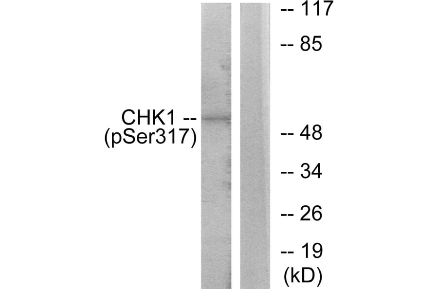 Western Blot - Anti-Chk1 (phospho Ser317) Antibody (A7041) - Antibodies.com