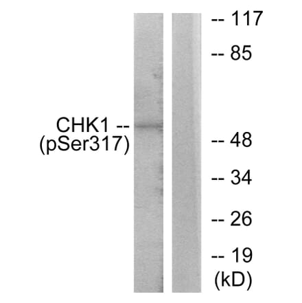Western Blot - Anti-Chk1 (phospho Ser317) Antibody (A7041) - Antibodies.com