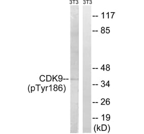 Western Blot - Anti-CDK9 (phospho Thr186) Antibody (A1028) - Antibodies.com