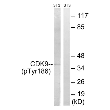 Western Blot - Anti-CDK9 (phospho Thr186) Antibody (A1028) - Antibodies.com