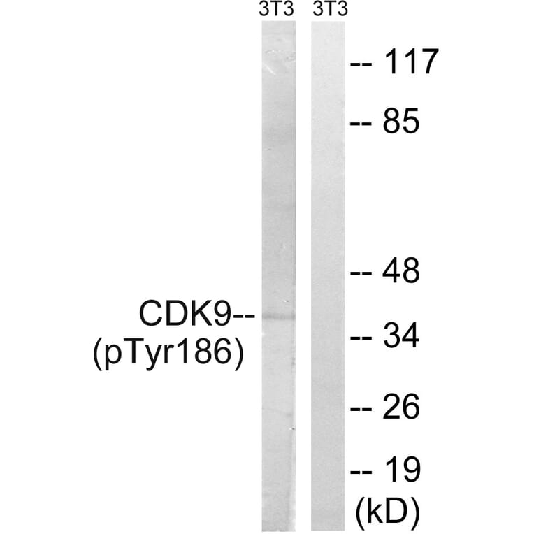Western Blot - Anti-CDK9 (phospho Thr186) Antibody (A1028) - Antibodies.com